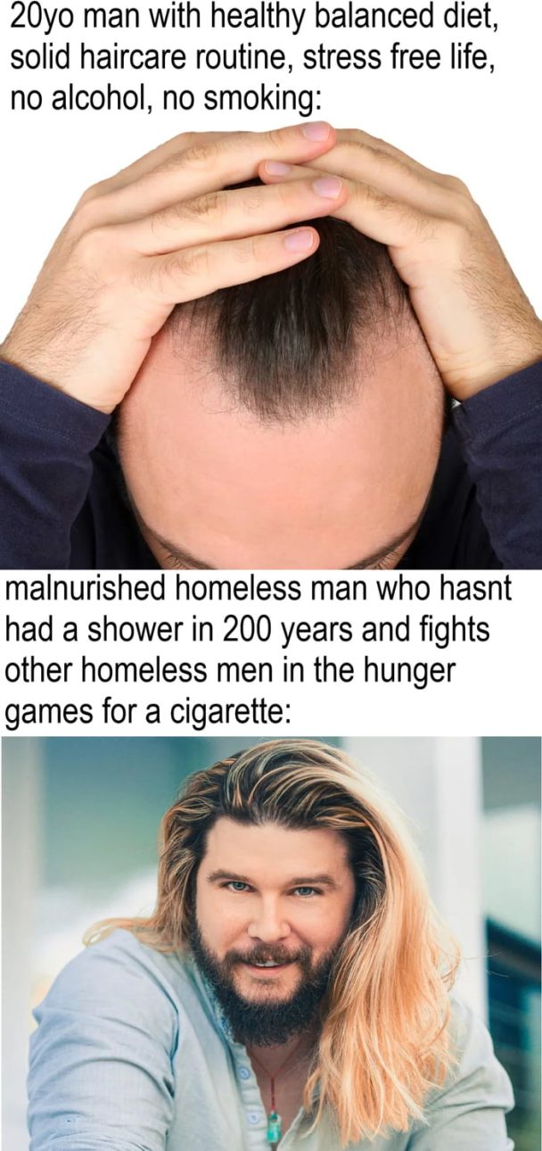 Being follicularly challenged is hard Being follicularly challenged is hard