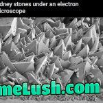 Nightmares of a urethra