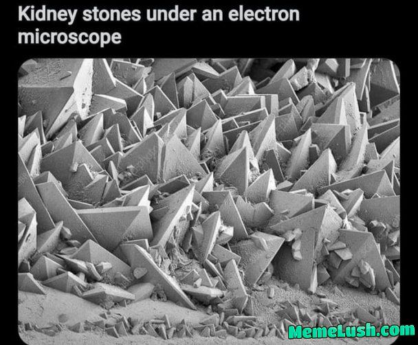 Nightmares of a urethra