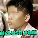 A 14 year old Vietnamese boy who was born without eyes because of the effects of Agent Orange