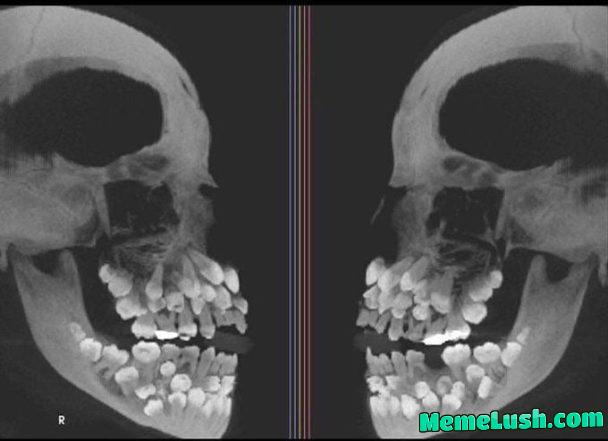 Nightmare fuel, bad hyper dont is Nightmare fuel, bad hyper dont is