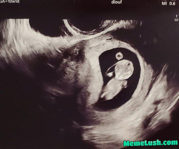 Hey you racist, misogynistic, bastards. I’m having a future 9gagger.