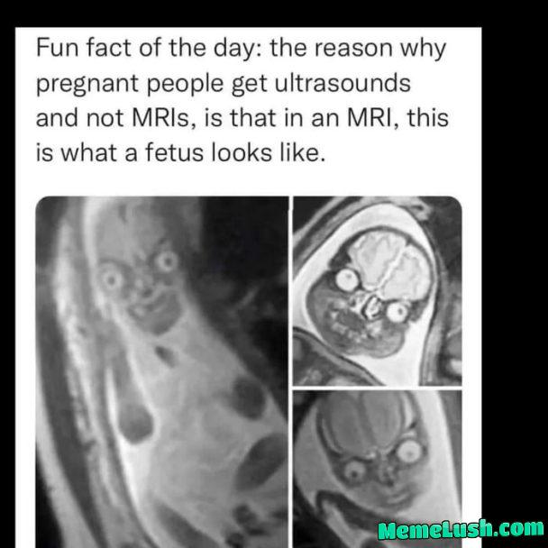 Well… that looks creepy Well… that looks creepy